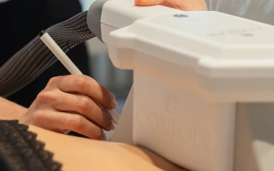 Cryolipolysis — SC RITUEL Beaune